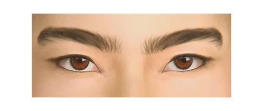 crybabies’ sclera;
