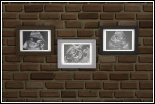 Ultrasound Scan